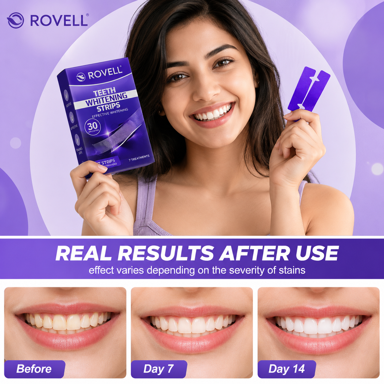 ROVELL™ Purple Teeth Whitening Strips | 7 Treatments